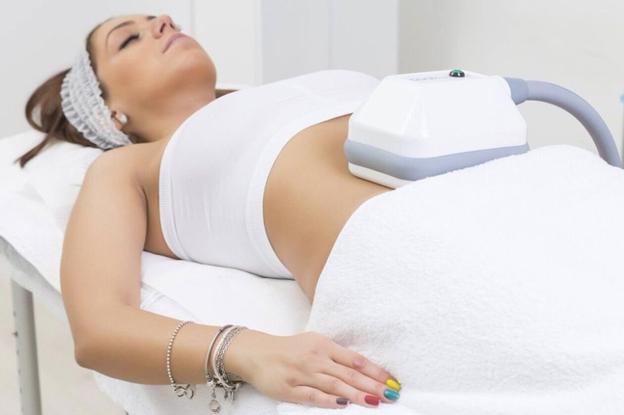 Cryolipolysis in Birmingham