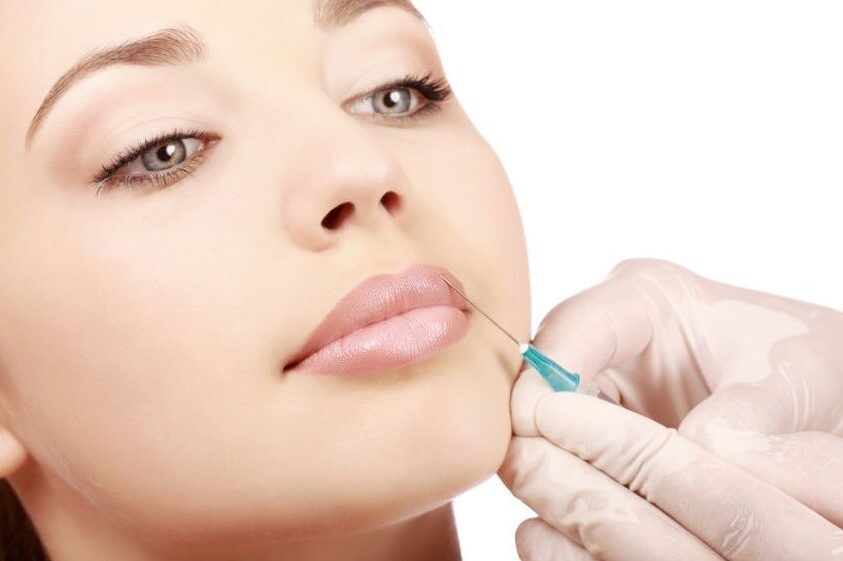 Dermal fillers in Birmingham