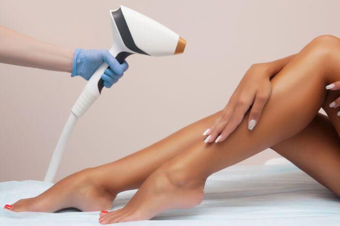 Laser Hair Removal in Birmingham